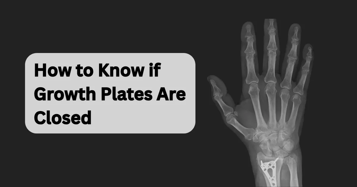 How to Know if Growth Plates Are Closed