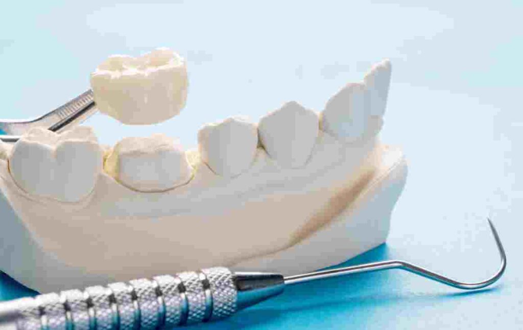 Fixed Prosthodontics: Technology, Trends & Modern Dental Labs